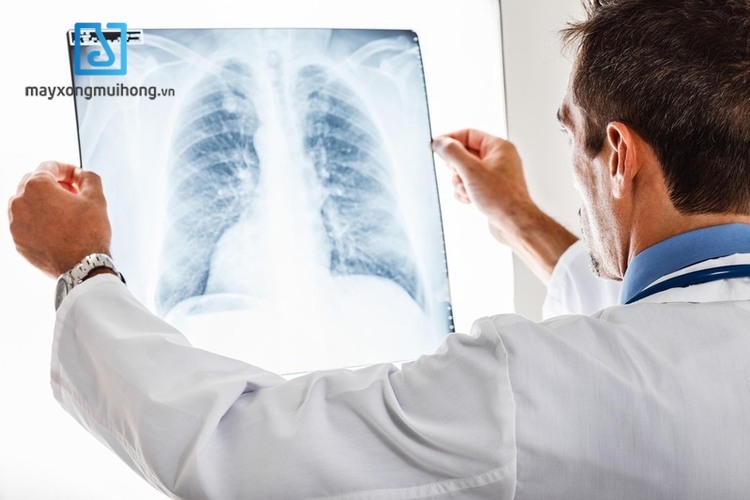 Bạn có thể được yêu cầu chụp X – quang phổi để kiểm tra nguyên nhân gây ra bệnh hen suyễn