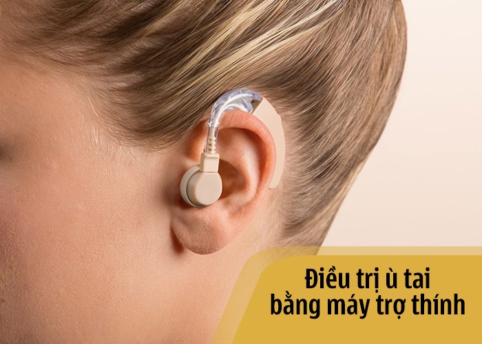 bệnh ù tai nên sử dụng máy trợ thính