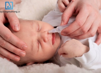Cách làm sạch mũi cho trẻ sơ sinh
